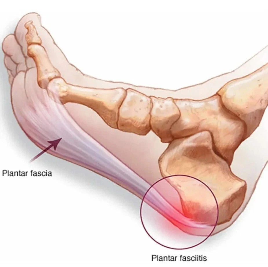 Slimflex Simple 3/4 Length Orthotic Insoles | Medium Density | Heel Arch Support