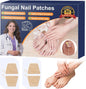 EASICUTI Fungal Nail Patches, 90 PCS Toenail Fungus Treatment Extra Strong, Over